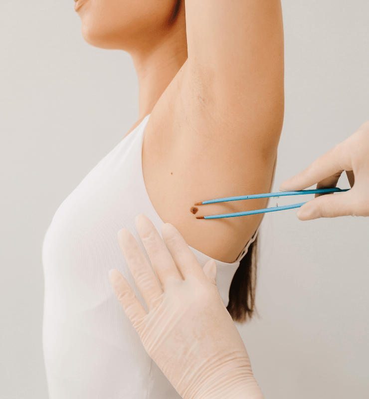 Treatment -  Bond Medical