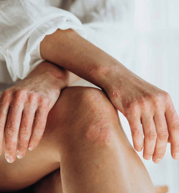 Treatment -  Bond Medical