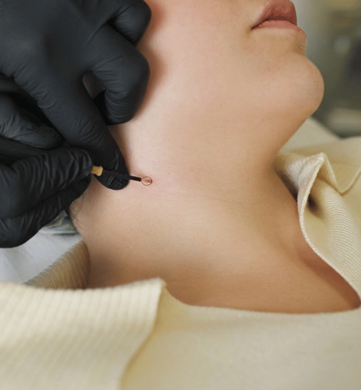 Treatment -  Bond Medical