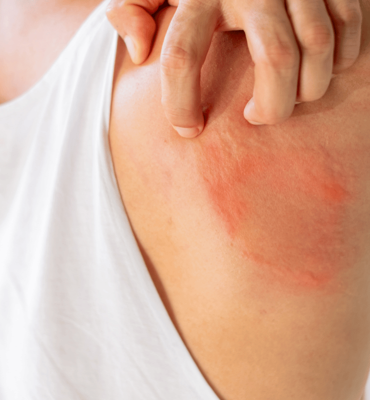 Treatment -  Bond Medical