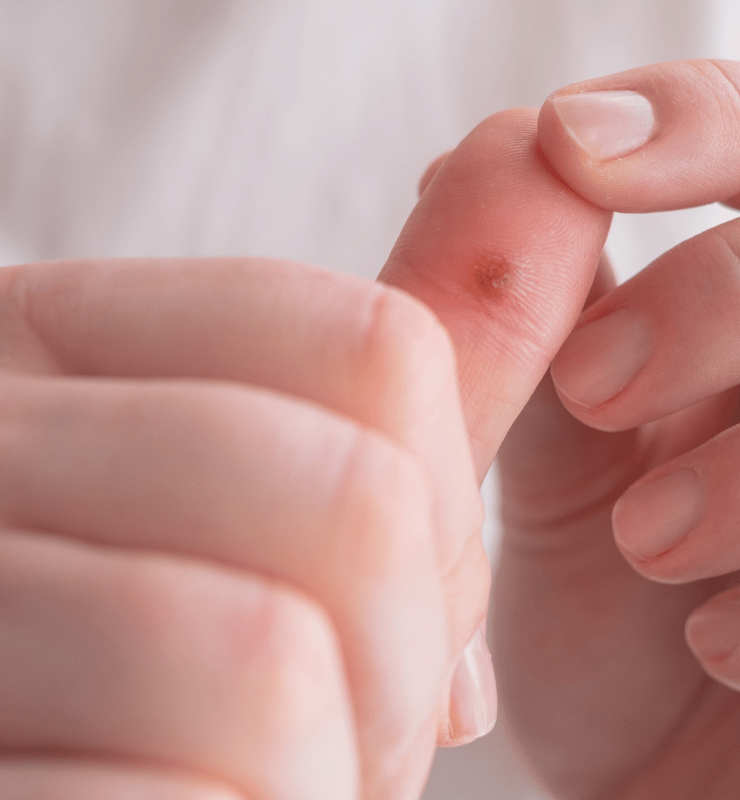 Treatment -  Bond Medical